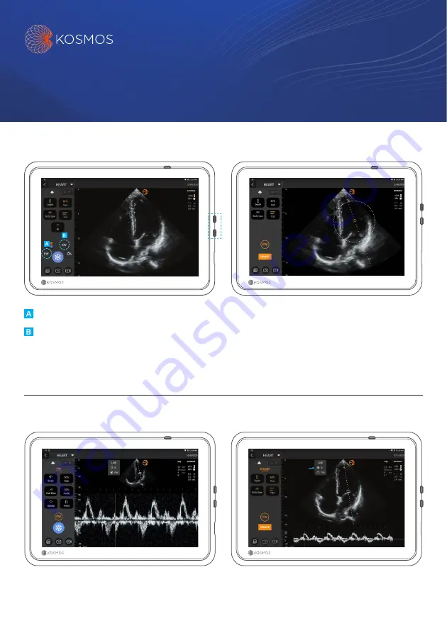 EchoNous KOSMOS Quick Manual Download Page 1