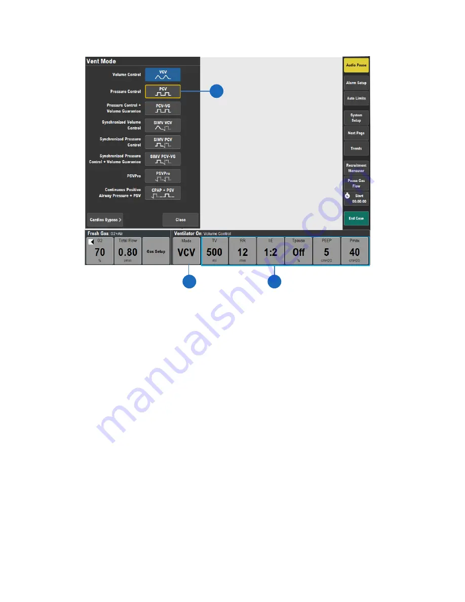 GE 750 Clinical Reference Manual Download Page 30