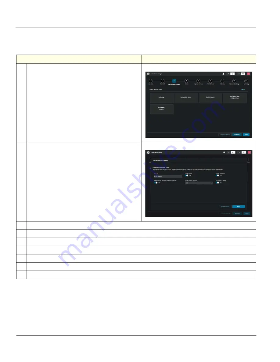 GE LOGIQ Totus Basic Service Manual Download Page 132