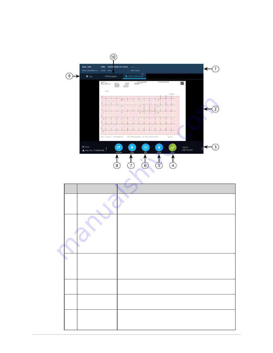 GE MAC VU360 Operator'S Manual Download Page 55