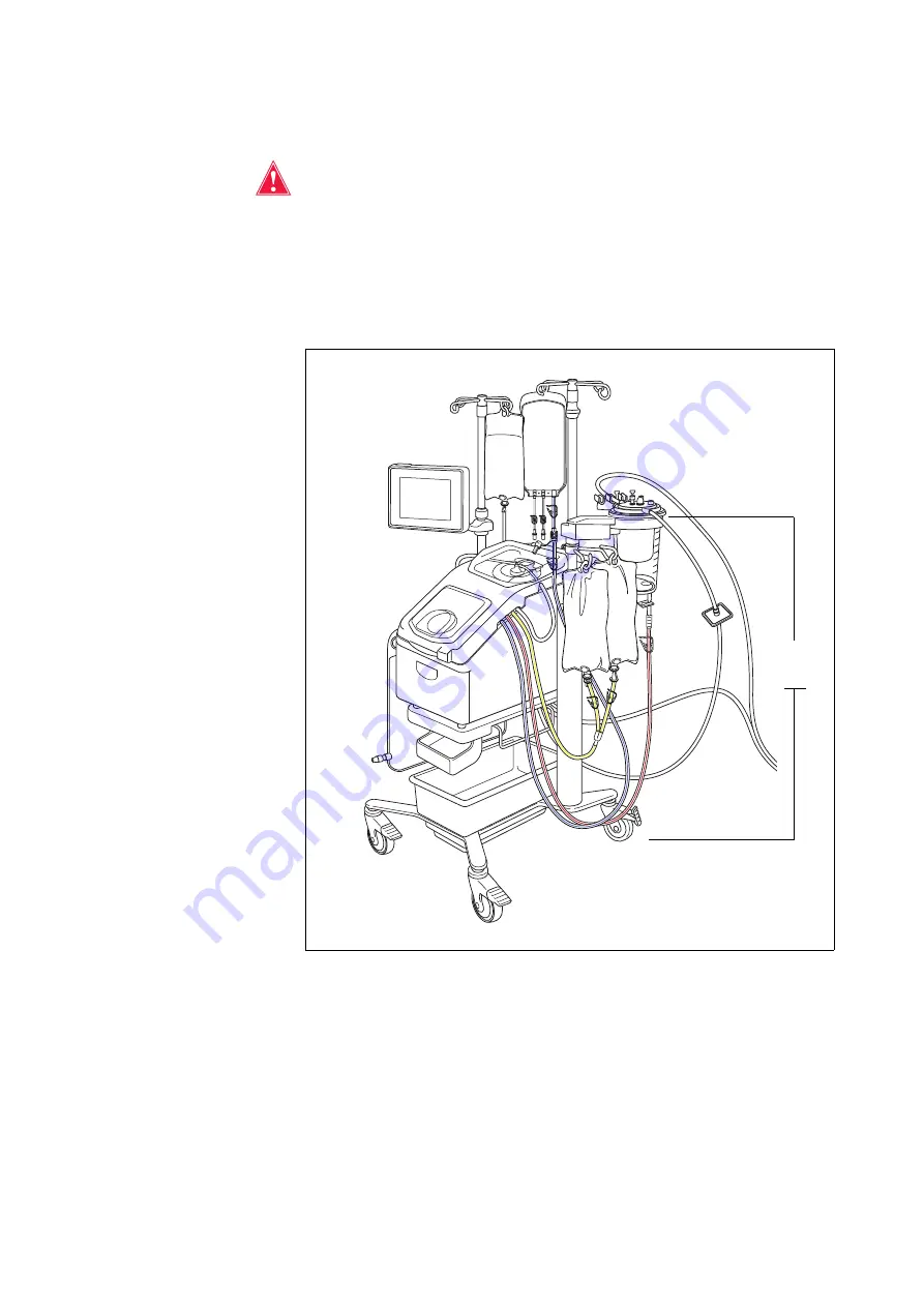 Haemonetics Cell Saver Elite User Manual Download Page 63