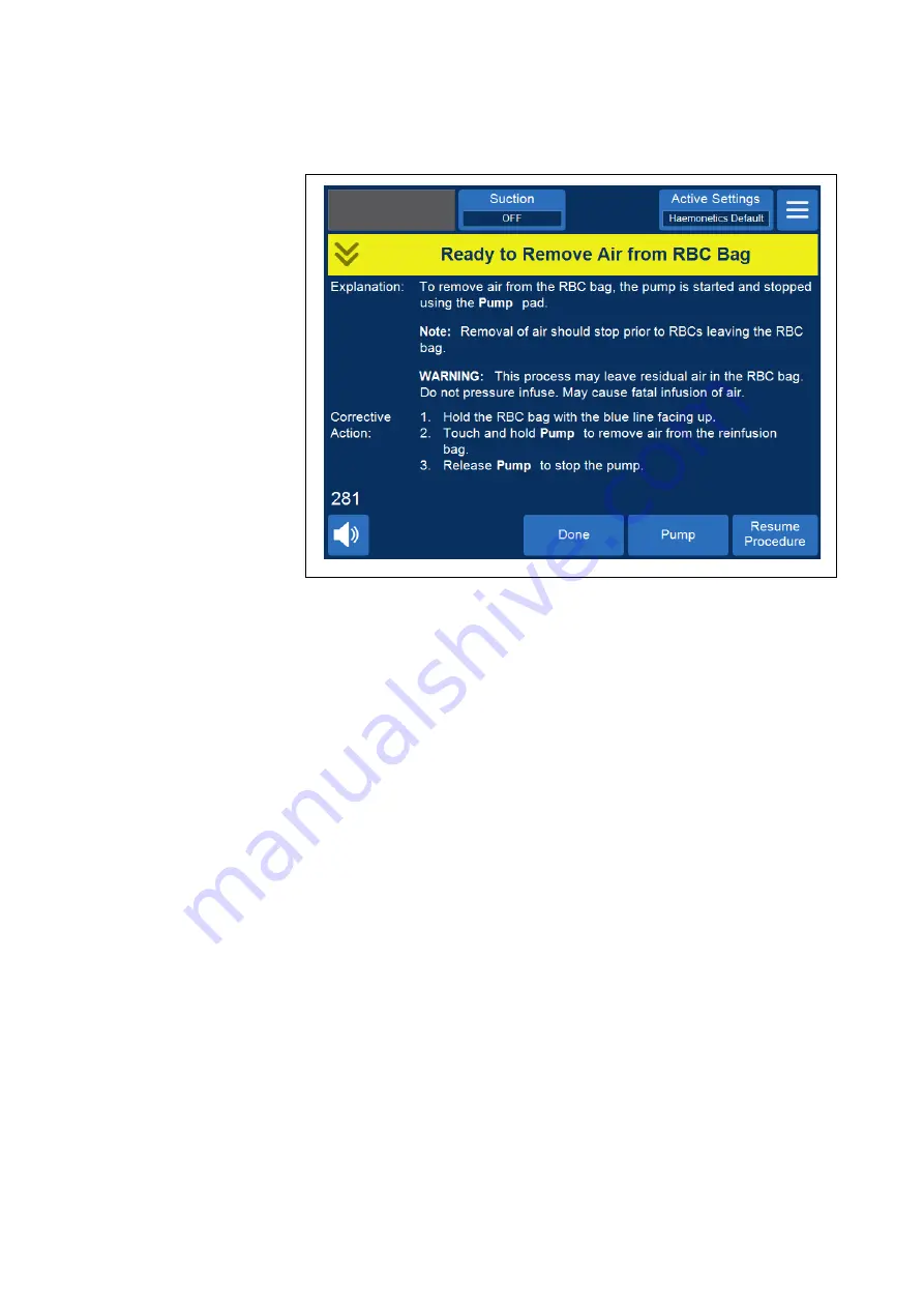 Haemonetics Cell Saver Elite User Manual Download Page 93