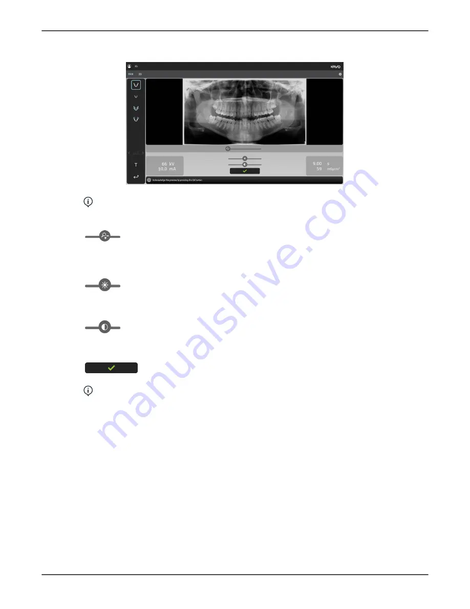 KaVo ORTHOPANTOMOGRAPH OP 3D User And Installation Manual Download Page 19