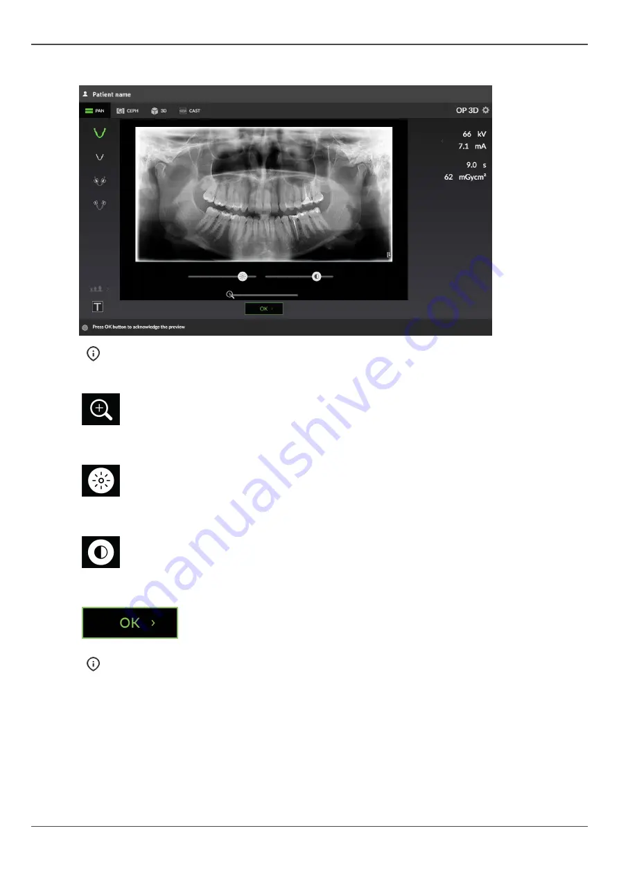 KaVo ORTHOPANTOMOGRAPH OP 3D Скачать руководство пользователя страница 21