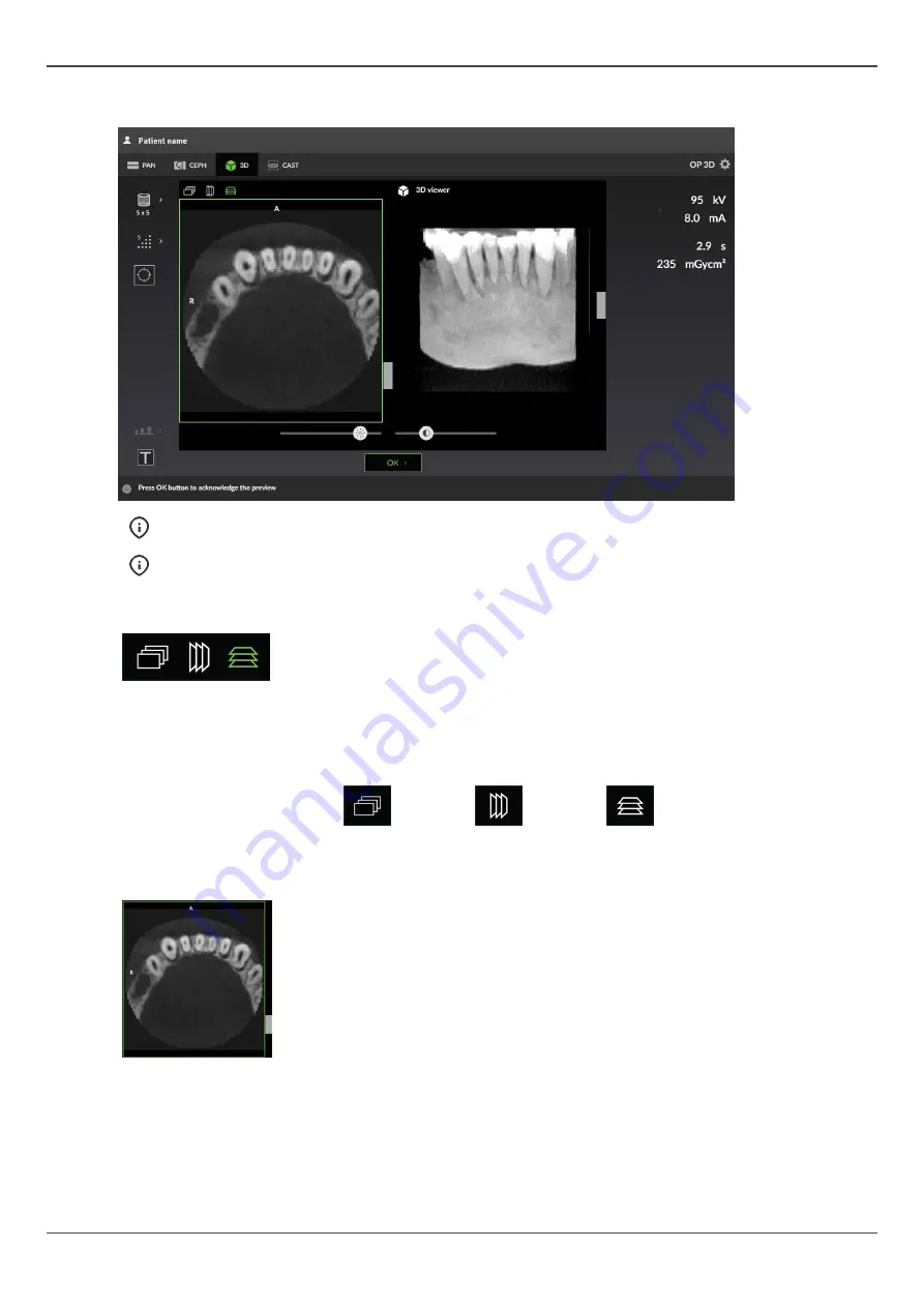 KaVo ORTHOPANTOMOGRAPH OP 3D Скачать руководство пользователя страница 29