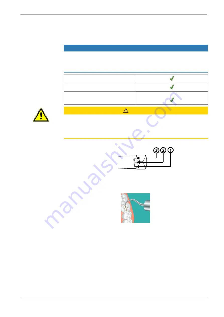 KaVo SONICflex seal 45 Instructions For Use Manual Download Page 13