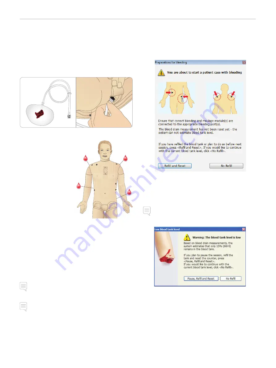 laerdal SimMan 3G Trauma Скачать руководство пользователя страница 20