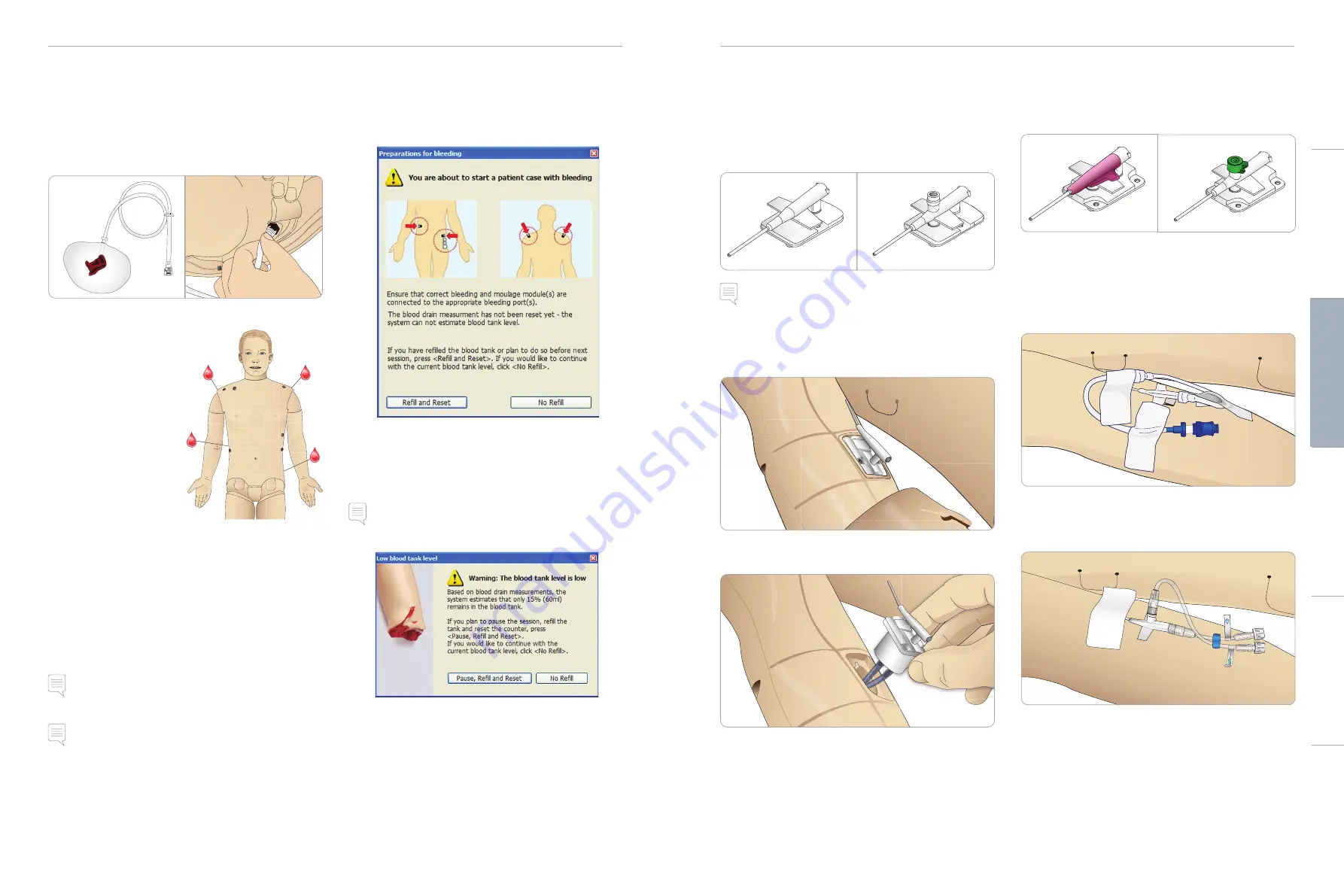 laerdal SimMan 3G User Manual Download Page 11