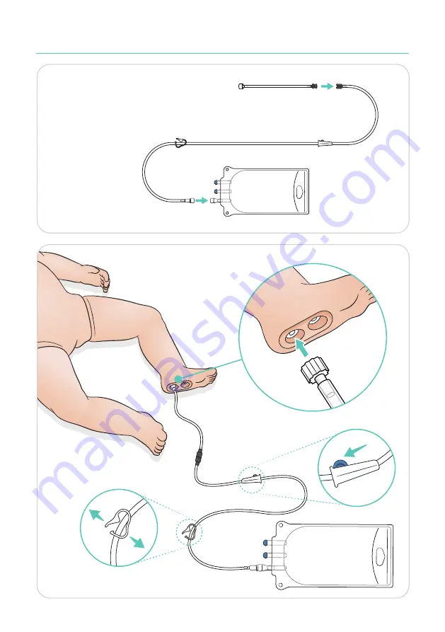 laerdal SimNewB User Manual Download Page 15