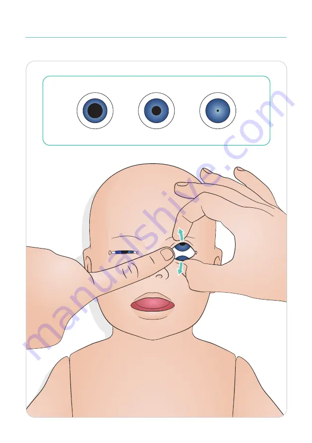 laerdal SimNewB Скачать руководство пользователя страница 16