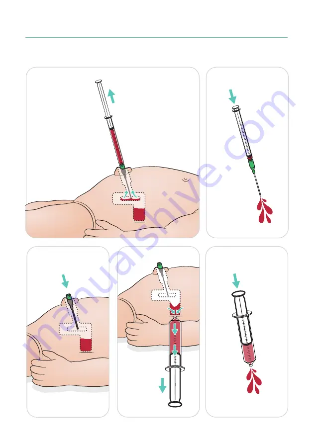 laerdal SimNewB Скачать руководство пользователя страница 30