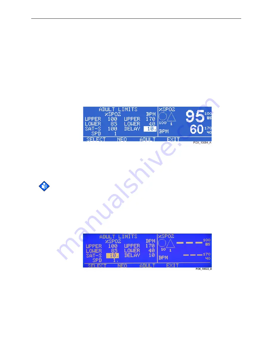 Nellcor OXIMAX N-600X Series Service Manual Download Page 78