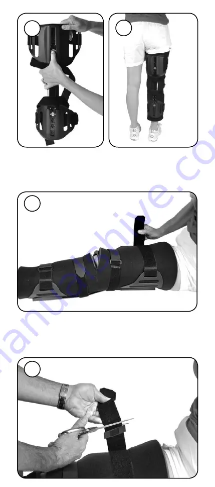 Össur Exoform Knee Immobilizer Скачать руководство пользователя страница 5