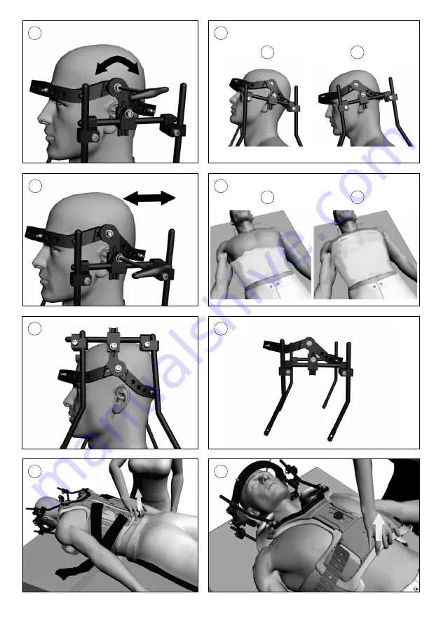 Össur Resolve Technical Manual Download Page 6