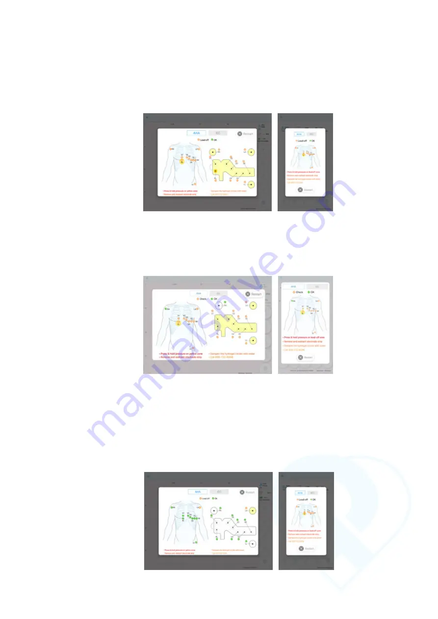 QT Medical QT ECG Recorder Troubleshooting Manual Download Page 10