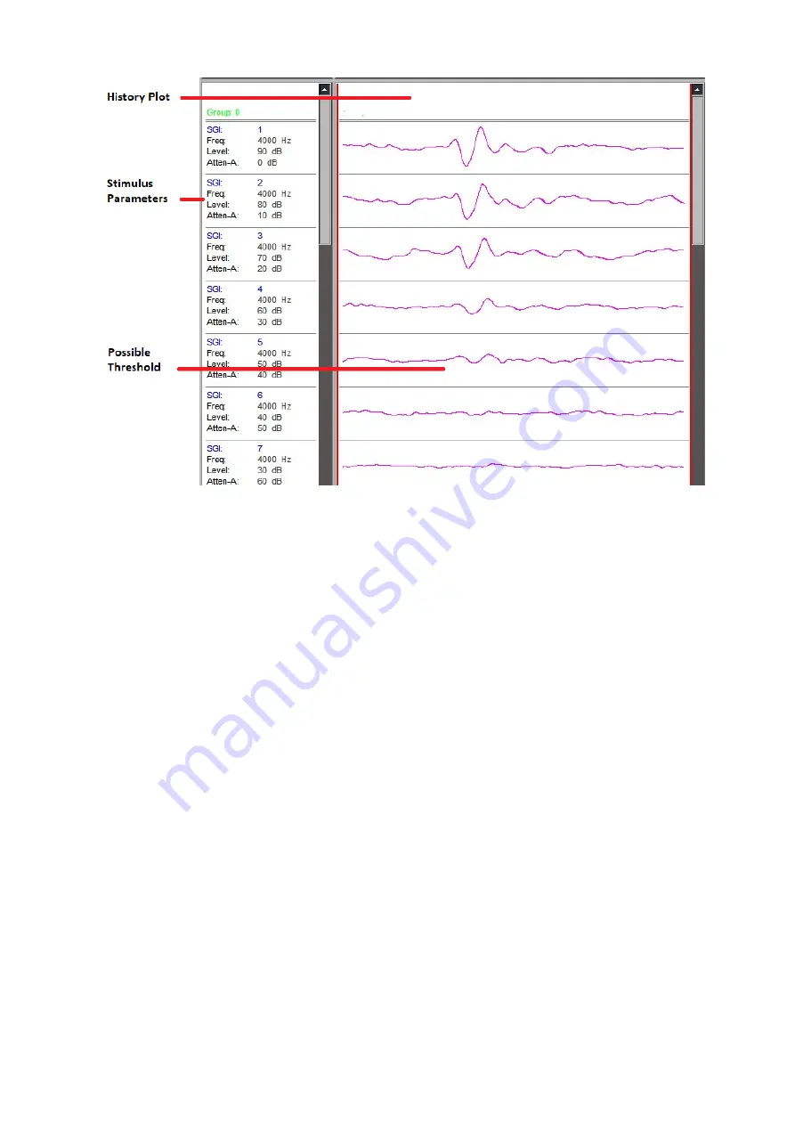 TDT Medusa4Z User Manual Download Page 7