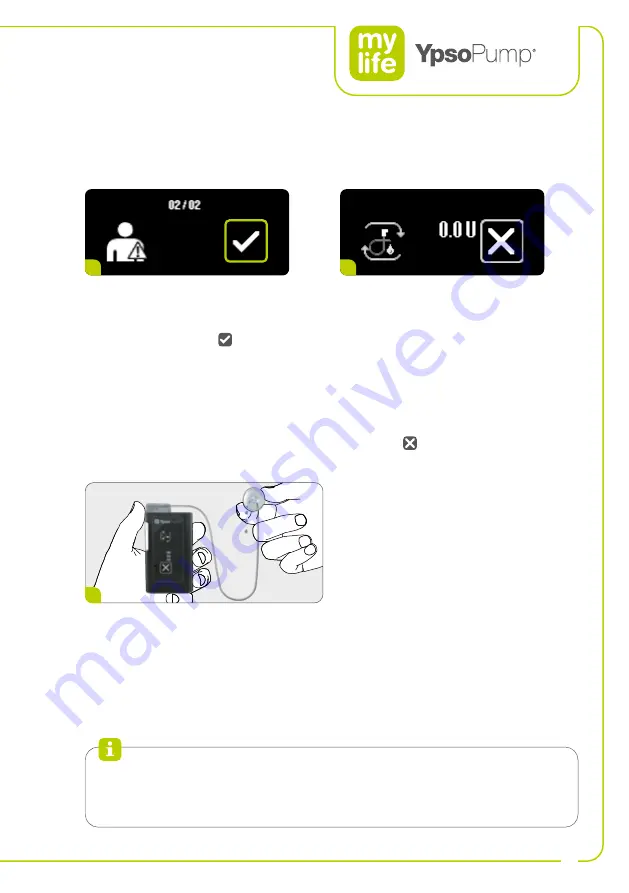 Ypsomed YpsoPump Manual Download Page 41