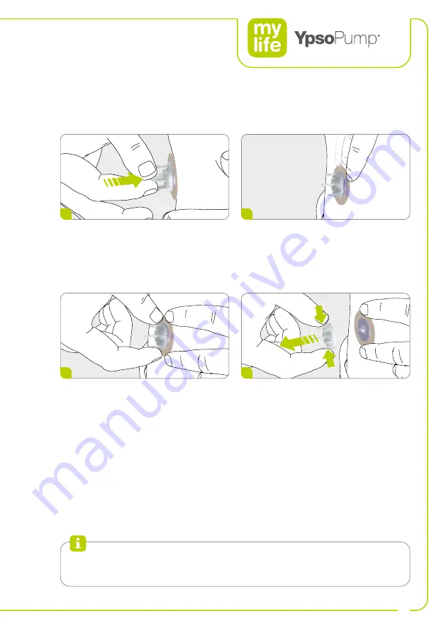 Ypsomed YpsoPump Manual Download Page 43