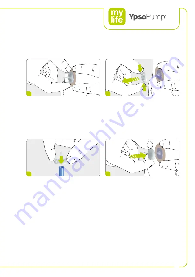 Ypsomed YpsoPump Manual Download Page 47