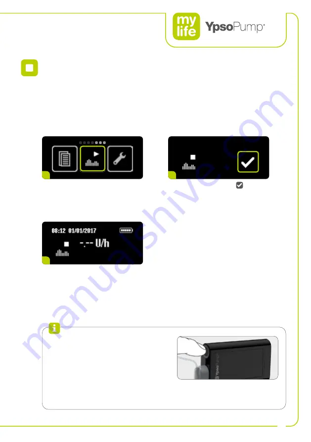 Ypsomed YpsoPump Manual Download Page 51