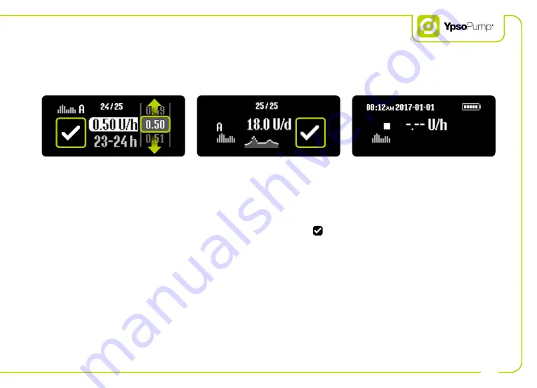 Ypsomed YpsoPump Quick Start Manual Download Page 19