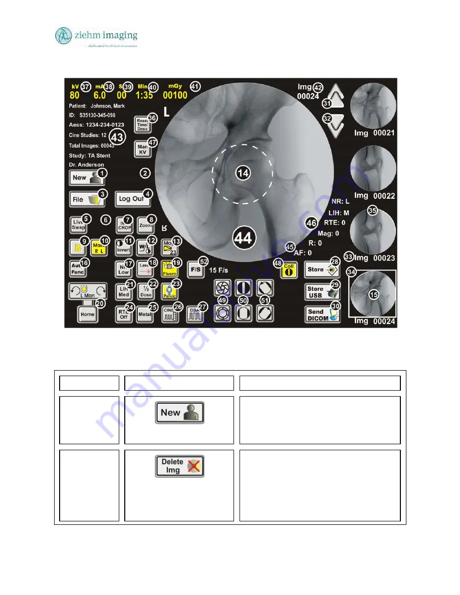 Ziehm Imaging, Inc. QUANTUM User Manual Download Page 61