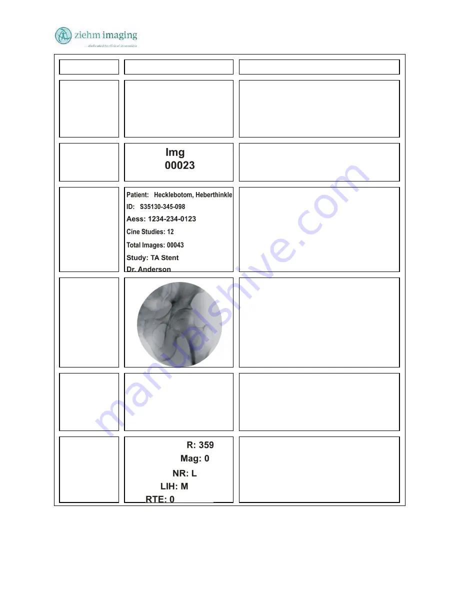 Ziehm Imaging, Inc. QUANTUM User Manual Download Page 69