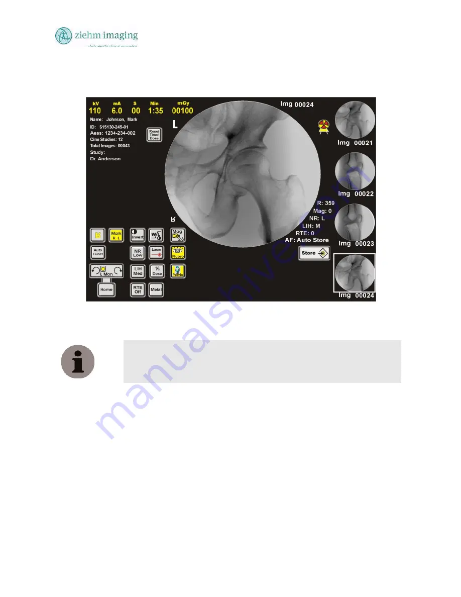 Ziehm Imaging, Inc. QUANTUM User Manual Download Page 72