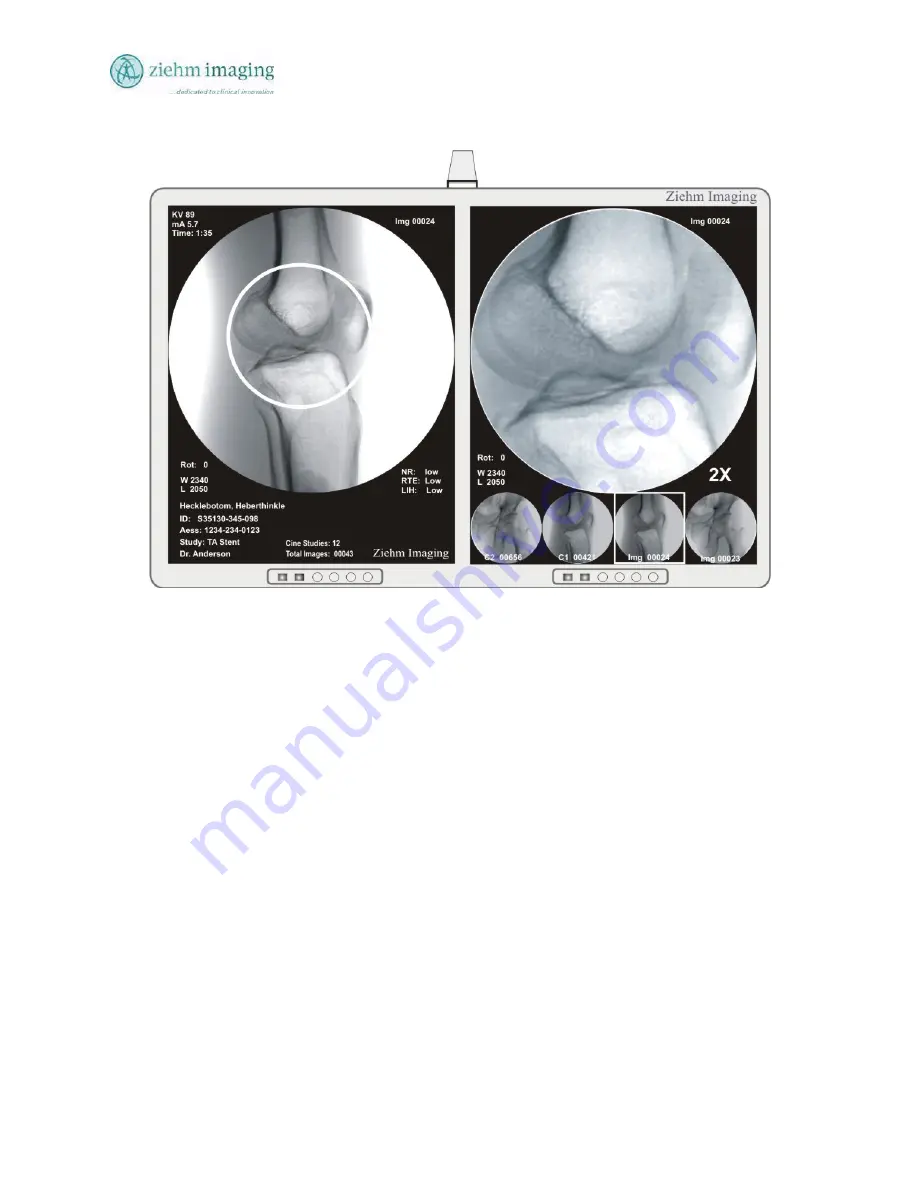 Ziehm Imaging, Inc. QUANTUM Скачать руководство пользователя страница 118