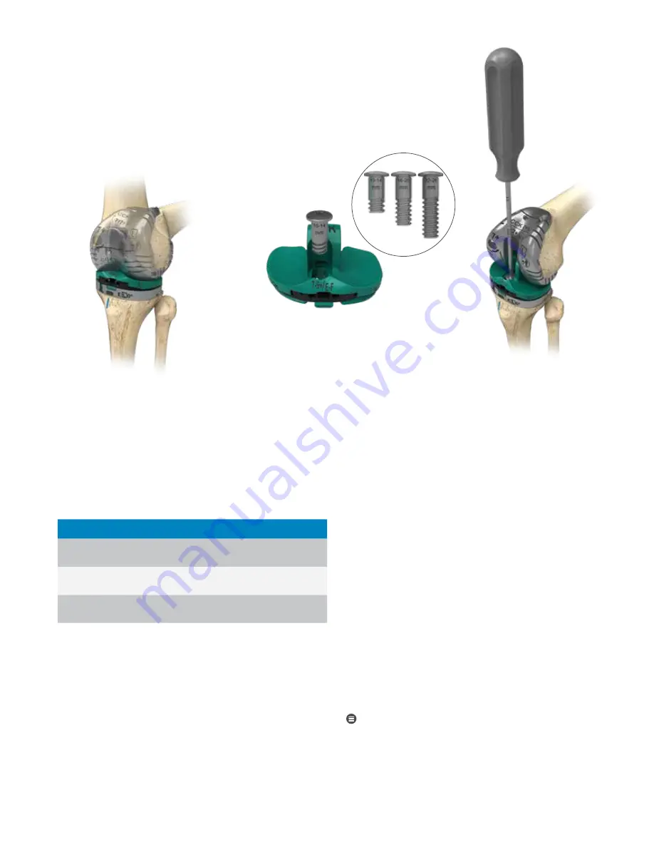 Zimmer Biomet Persona Surgical Technique Download Page 36