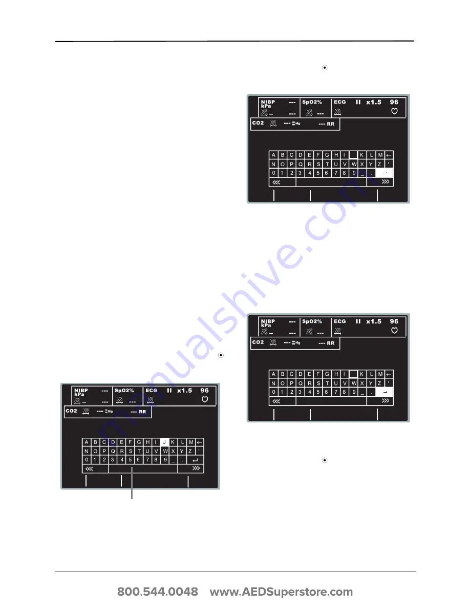 ZOLL E Series Operator'S Manual Download Page 35