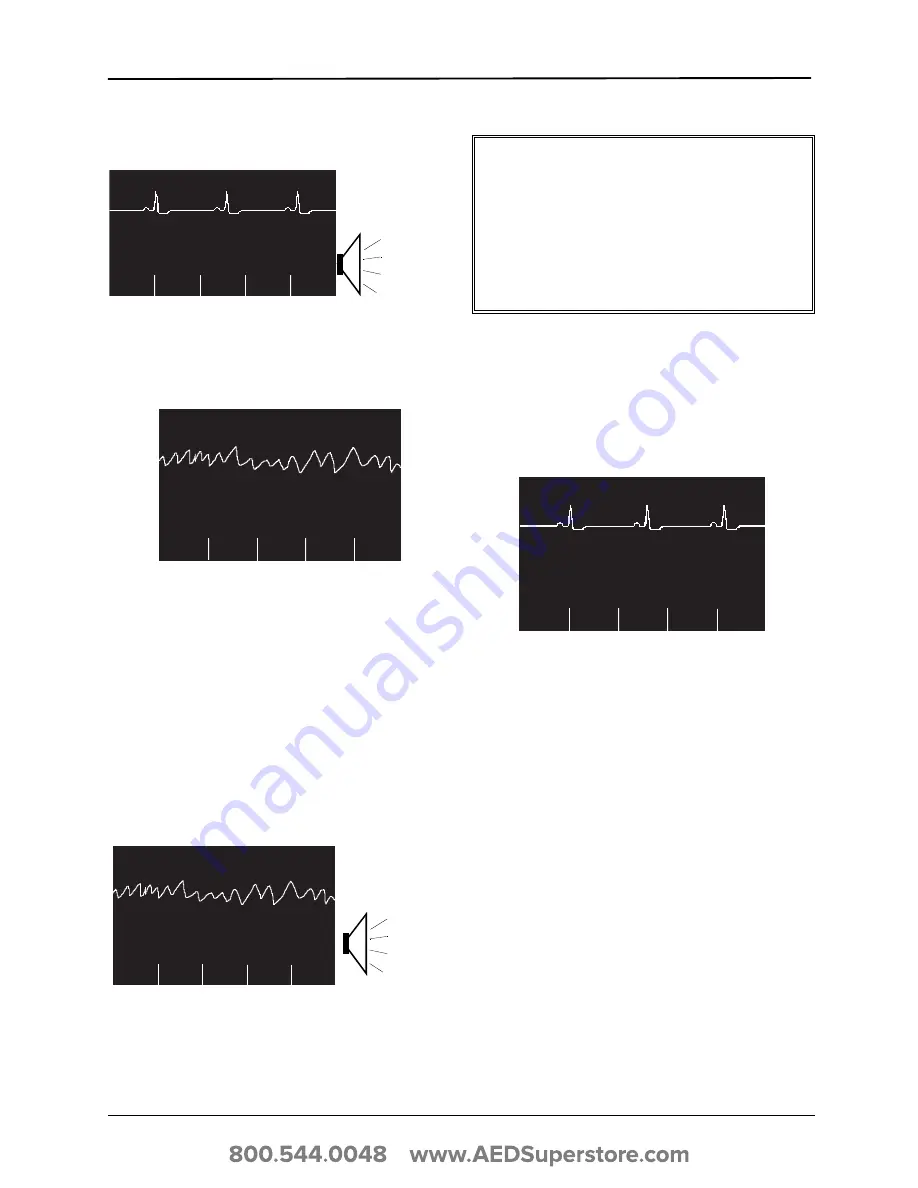 ZOLL E Series Operator'S Manual Download Page 50