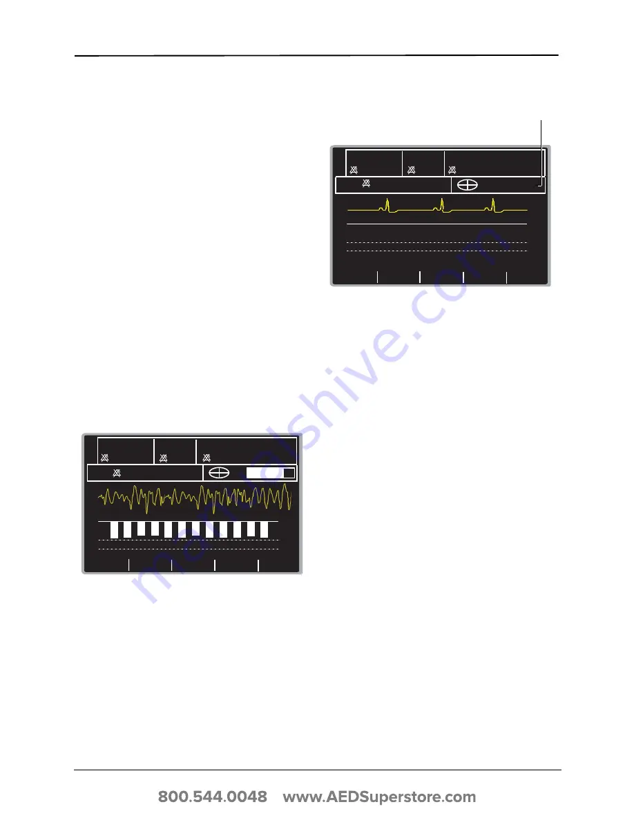 ZOLL E Series Operator'S Manual Download Page 59