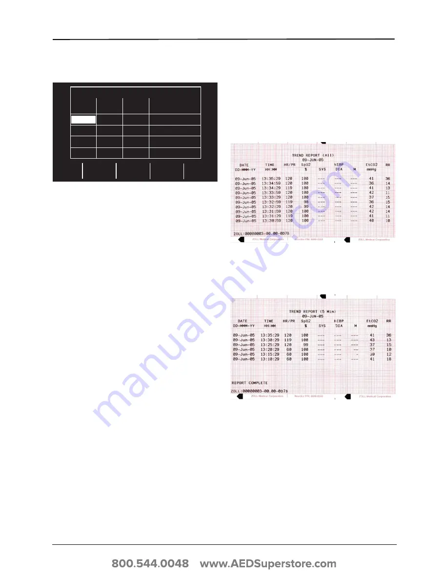 ZOLL E Series Operator'S Manual Download Page 77