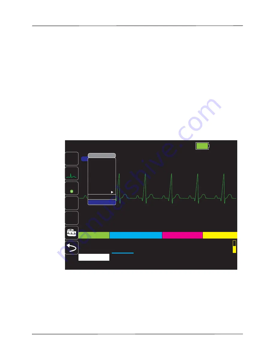 ZOLL Propaq MD Operator'S Manual Download Page 67